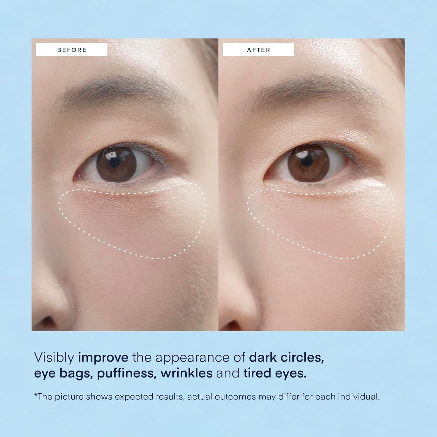 Terez & Honor Under Eye Patches for Dark Circles - 60 Korean Hydrogel Masks for Puffiness, Bags, Wrinkle with Caffeine, Hyaluronic Acid, Niacinamide - Undereye Hydrating & Cooling, Vegan, No Fragrance - Image 4