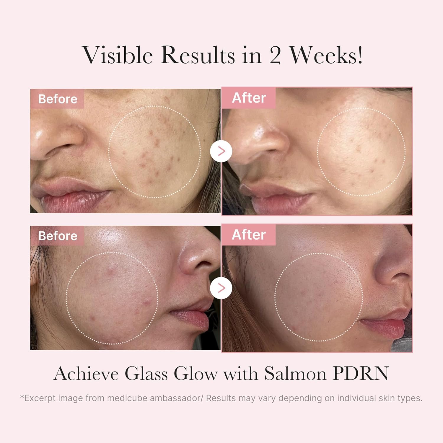medicube Salmon DNA PDRN Trial Kit | Glass Glow Mini Skincare Set with Toner, Serum & Sheet Mask for Hydrating, Firming, Moisturizing |Gift & Travel Essentials for Women & Girls | Korean Skincare - Image 3