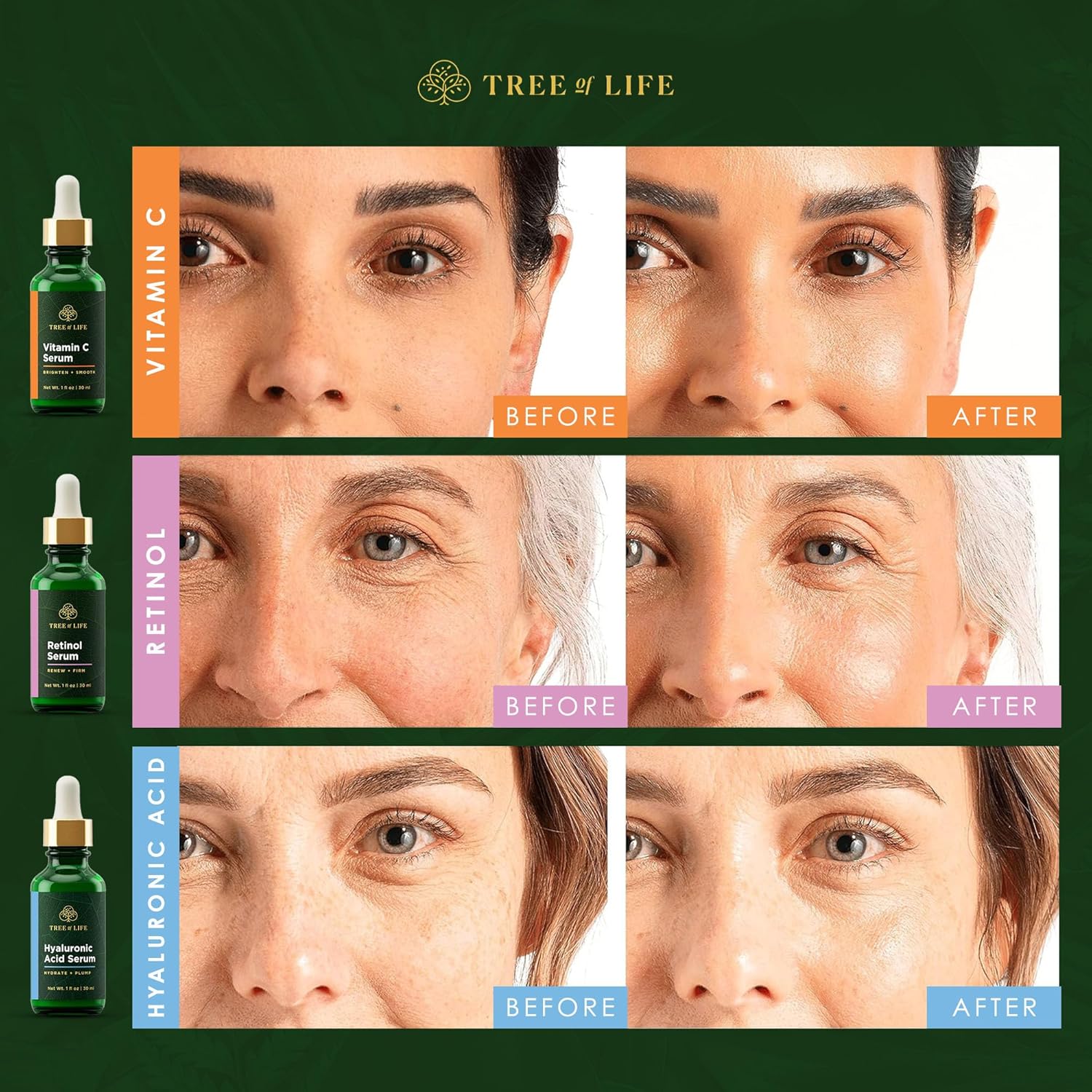 Tree of Life Beauty Facial Skin Care Set, Brightening, Firming & Hydrating Face Serums - Vitamin C, Retinol & Hyaluronic Acid for Smooth Radiant Skin, Dermatologist Tested, 1 Fl Oz (Pack of 3) - Image 7